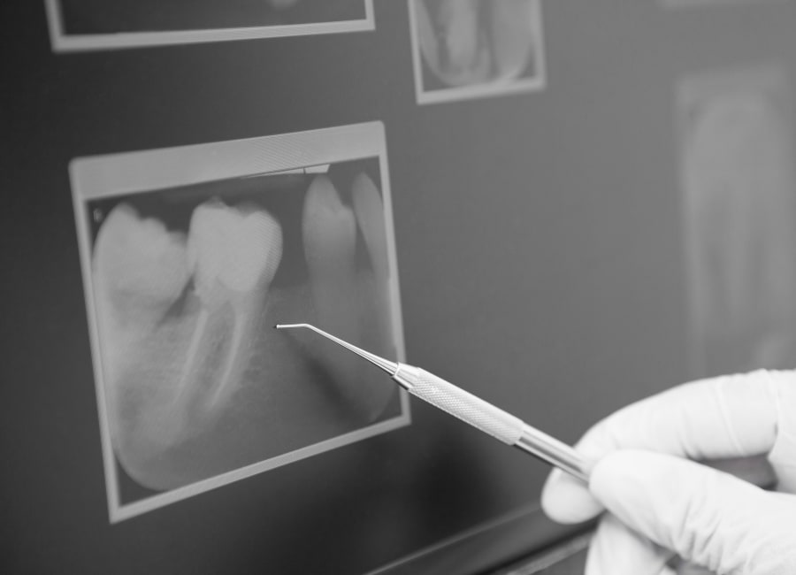 A dental professional holding a dental tool pointing to an X-ray image on a computer monitor.