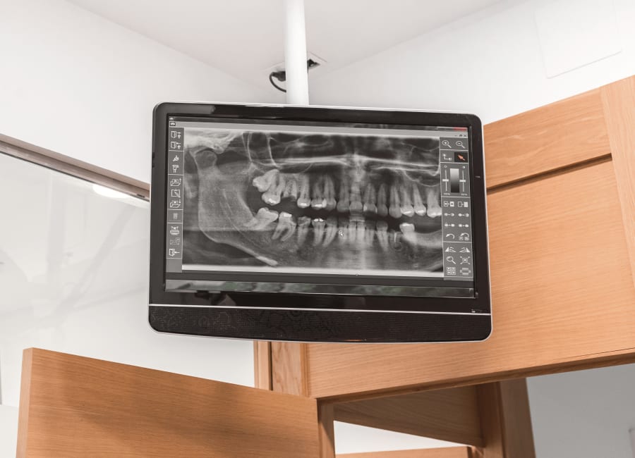 A monitor hanging from the ceiling in a dental office showing an image of a panoramic X-ray.