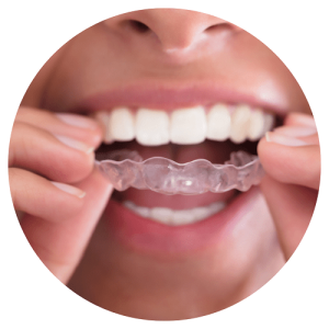 Invisalign Vancouver Island
